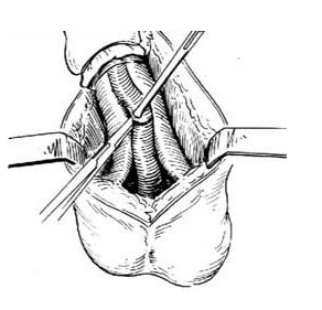 上海包皮手术哪里好