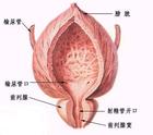 前列腺炎的早期症状图片