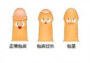 ҽ�ΰ�Ƥ����