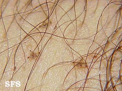 ͼ����ʭ���������������ʭ